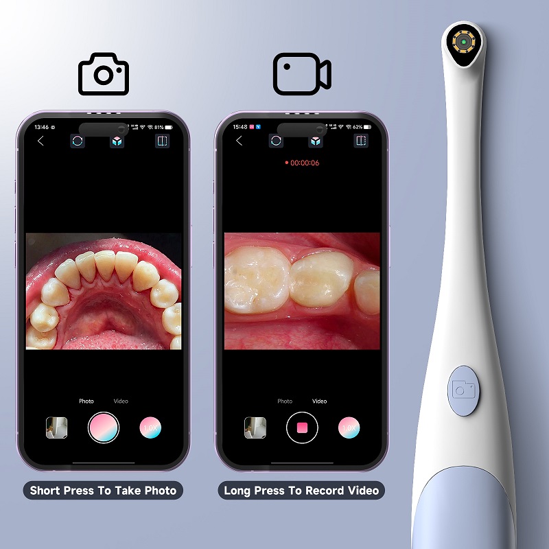 TYPE-C Visual Oral Camera for  - Endoscope Inspection Camera review and price
