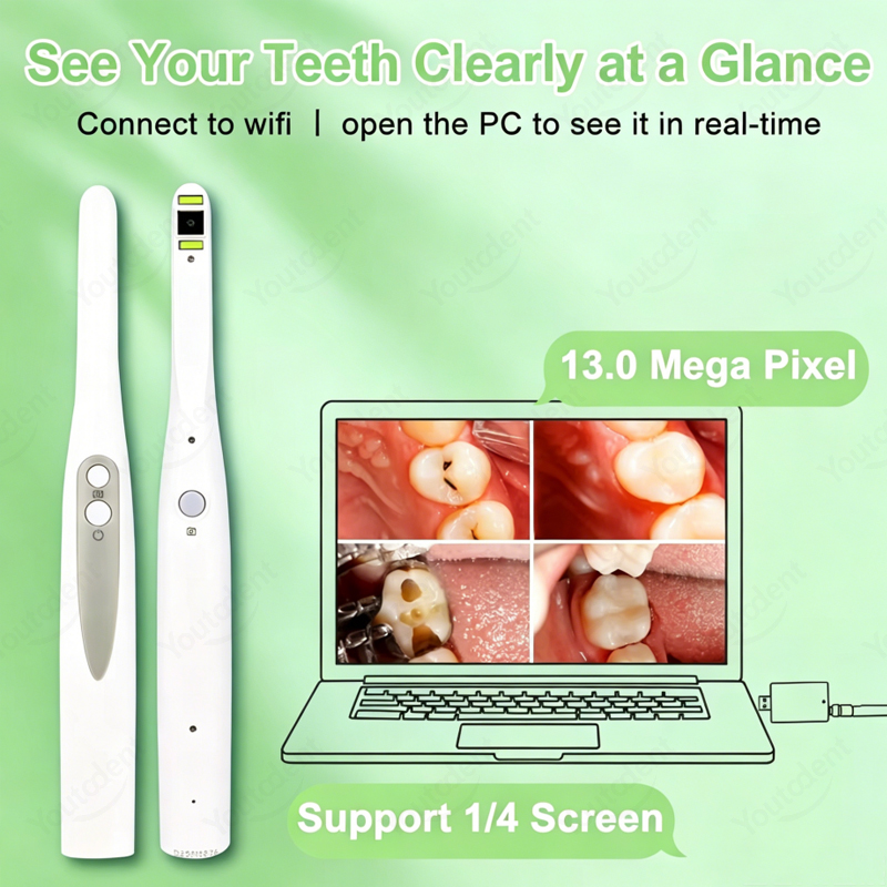 Wireless WIFI Dental Intraoral - Endoscope Inspection Camera review and price