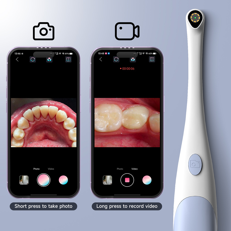 2 in 1 Oral Camera for Type-C/ - Endoscope Inspection Camera review and price